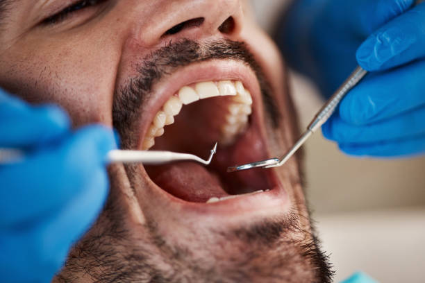 Best Emergency Root Canal Therapy in Saluda, SC