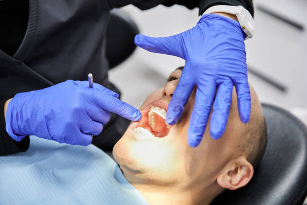 Best Emergency Care for Gum Disease in Saluda, SC
