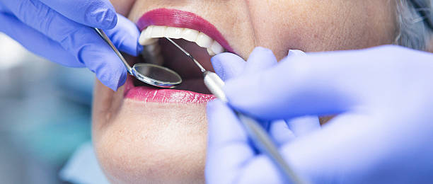 Best Emergency Cosmetic Dentistry (e.g., broken veneers) in Saluda, SC